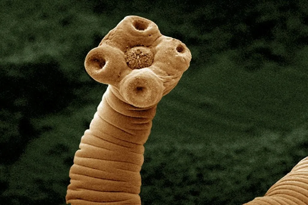 Tapeworms, like this one imaged using a scanning electron micrograph, weaken their victims but don’t typically kill them.